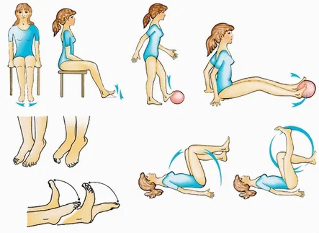 Varices des veines des membres inférieurs - prévention